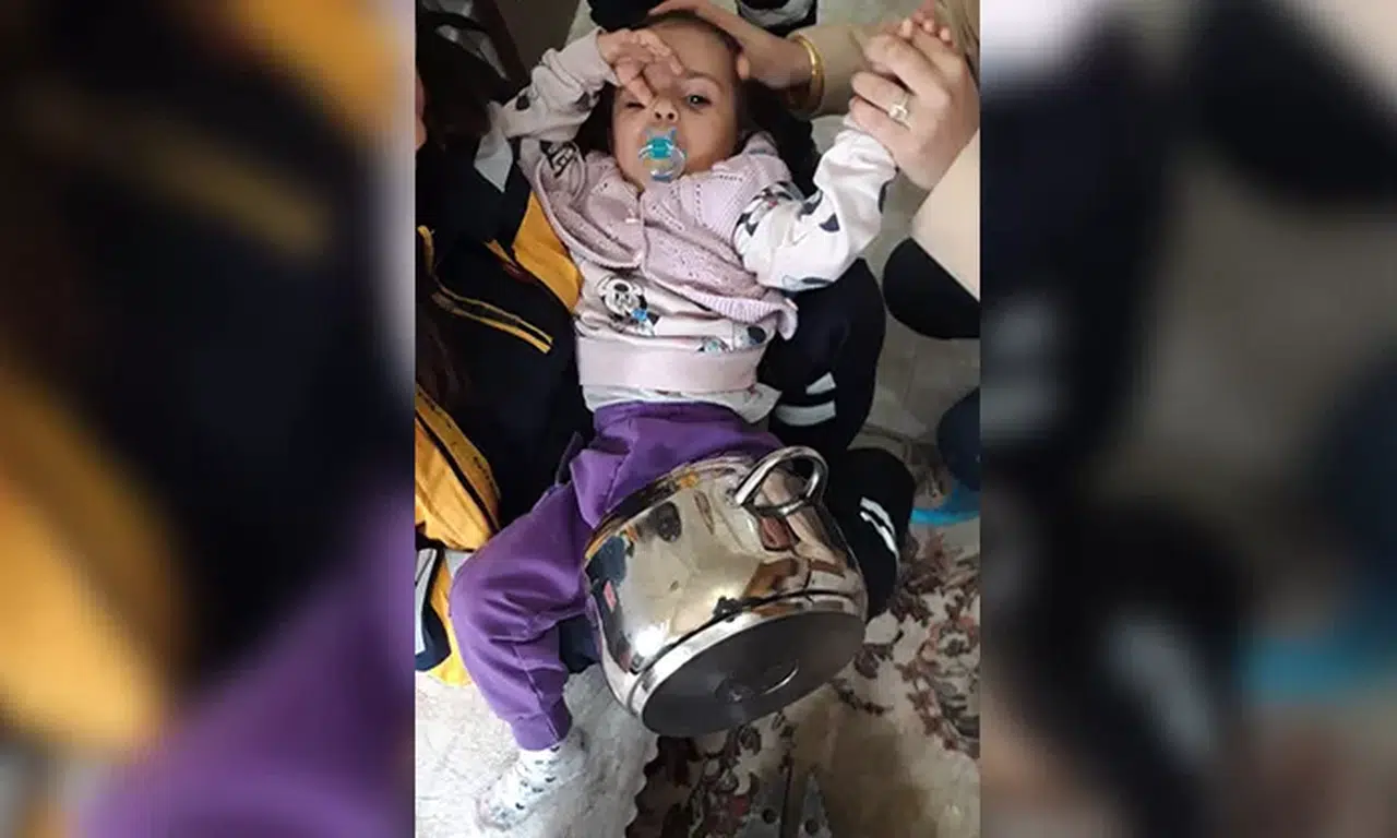 Çorum’da Bebek, Tencereye Sıkıştı, İtfaiye Güçlükle Kurtardı