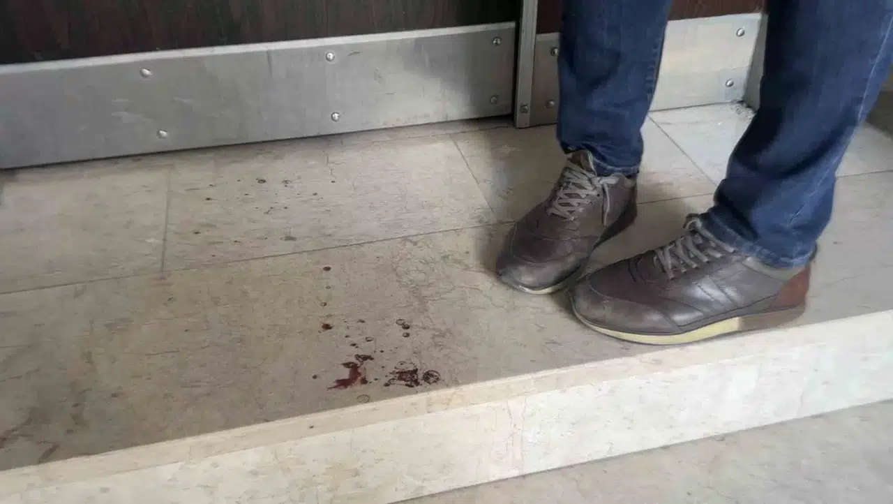 İstanbul’da Üniversite Öğrencisi Genç Kıza Bıçaklı Akın: “Abi Korkuttun Beni” Dediği Şahıs Belinden Bıçakladı