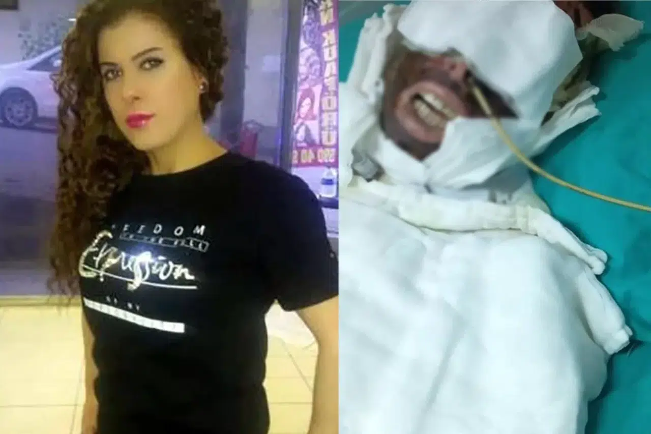 Avcılar’da Eski Sevgilisine Kimyasal Unsur ile Saldıran Sanığın Yargılanmasına Devam Edildi