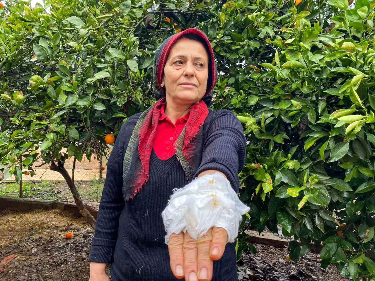 Yumurta Toplamak İçin Bahçeye Giren Bayan, Dobermanın Saldırısına Uğradı