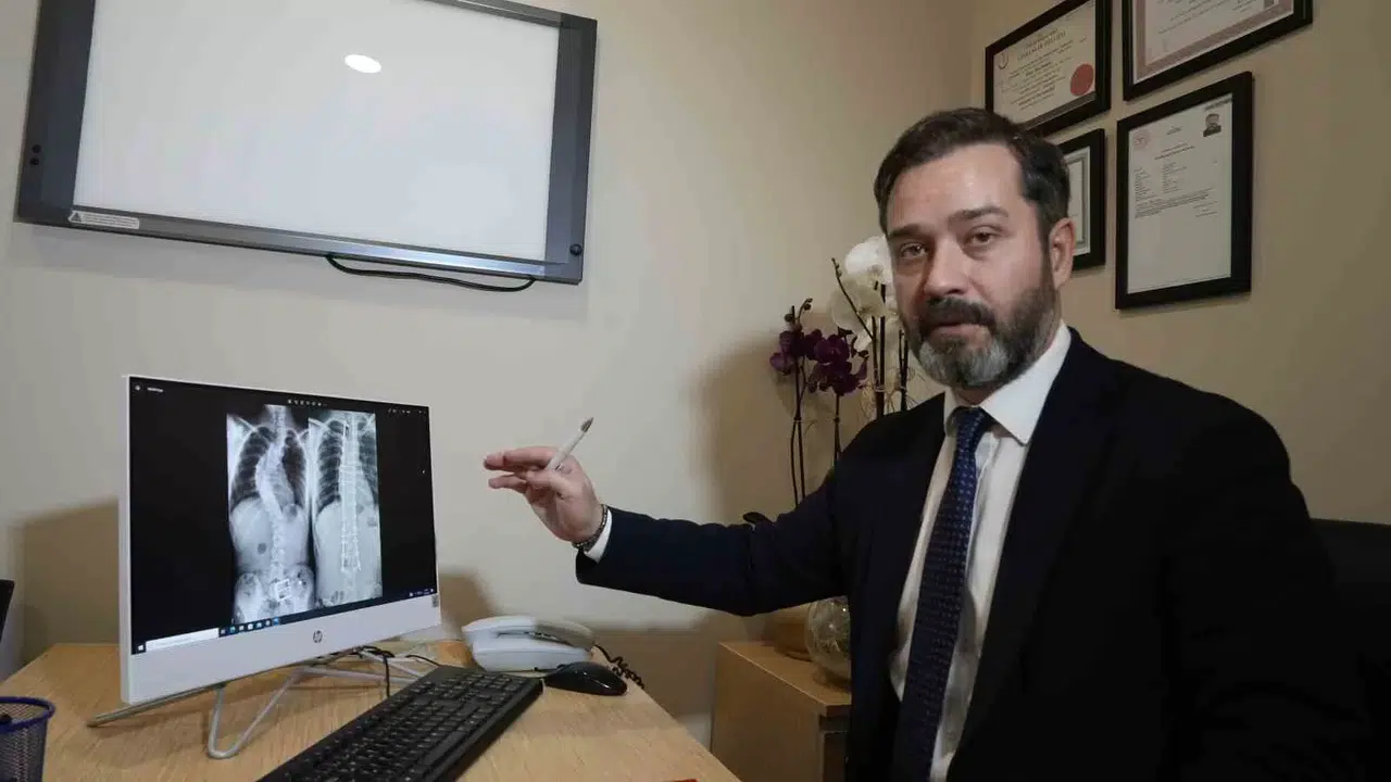 Skolyozun Belirlenmesinde Ailelere Büyük Vazife Düşüyor