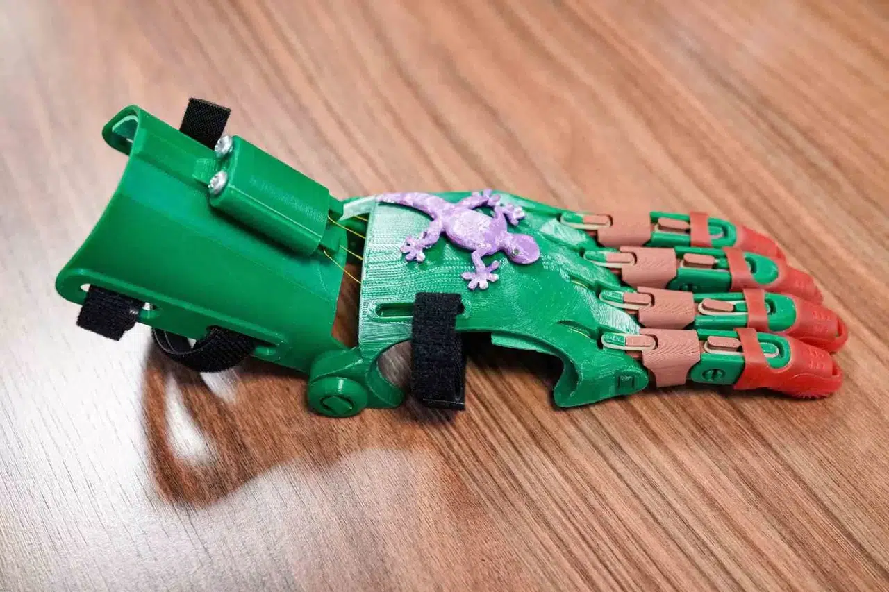 Büyükşehir Çocuklara Robot El ile Umut Olacak