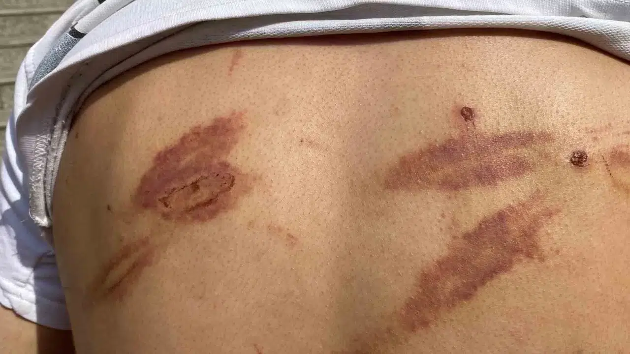 Öldüresiye Darp Edilmişti, Yaşadıklarını Anlattı
