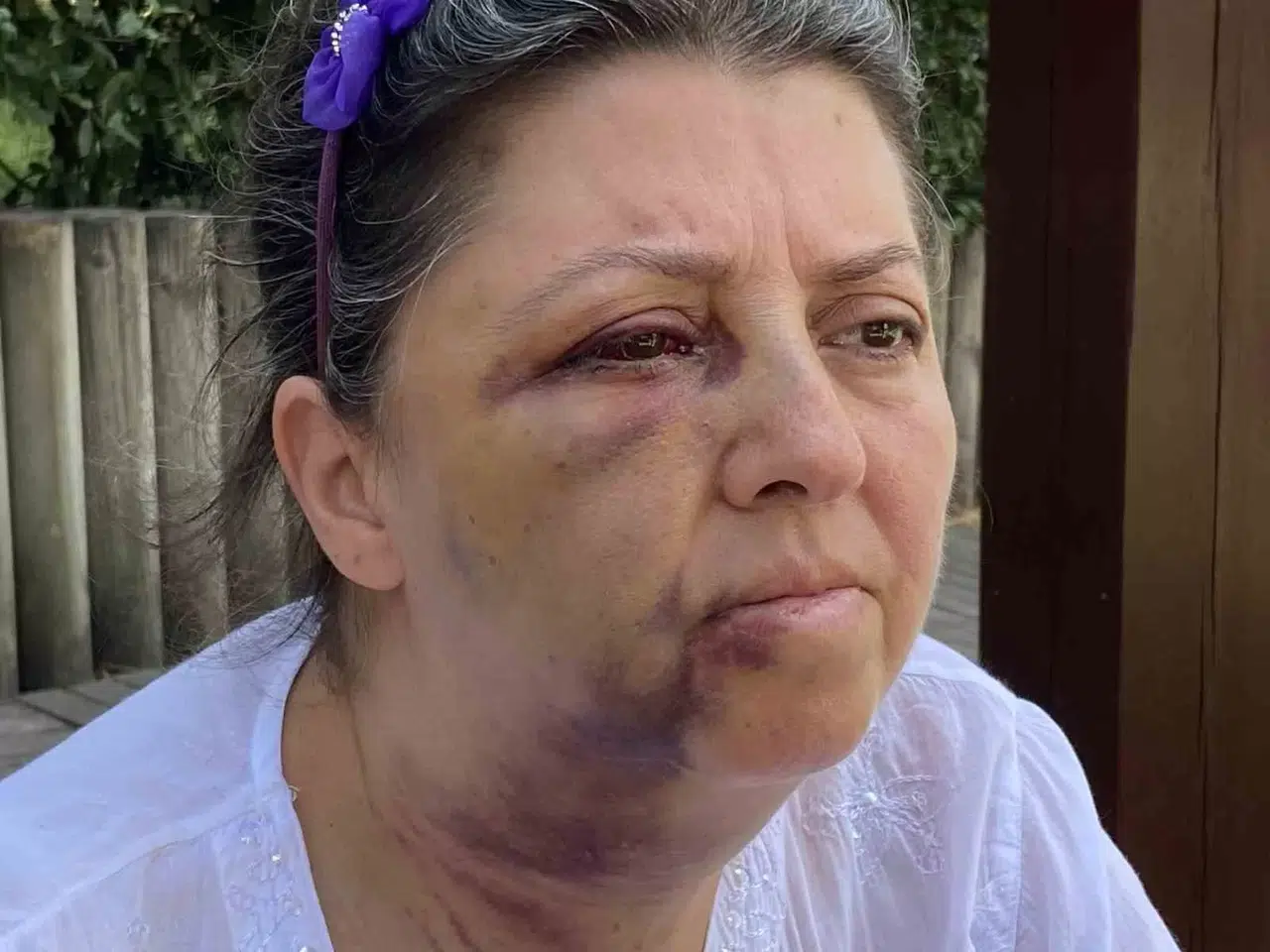 Küçükçekmece’de Kedi Besleyen İki Kız Kardeşi Komşularının Saldırısına Uğradı