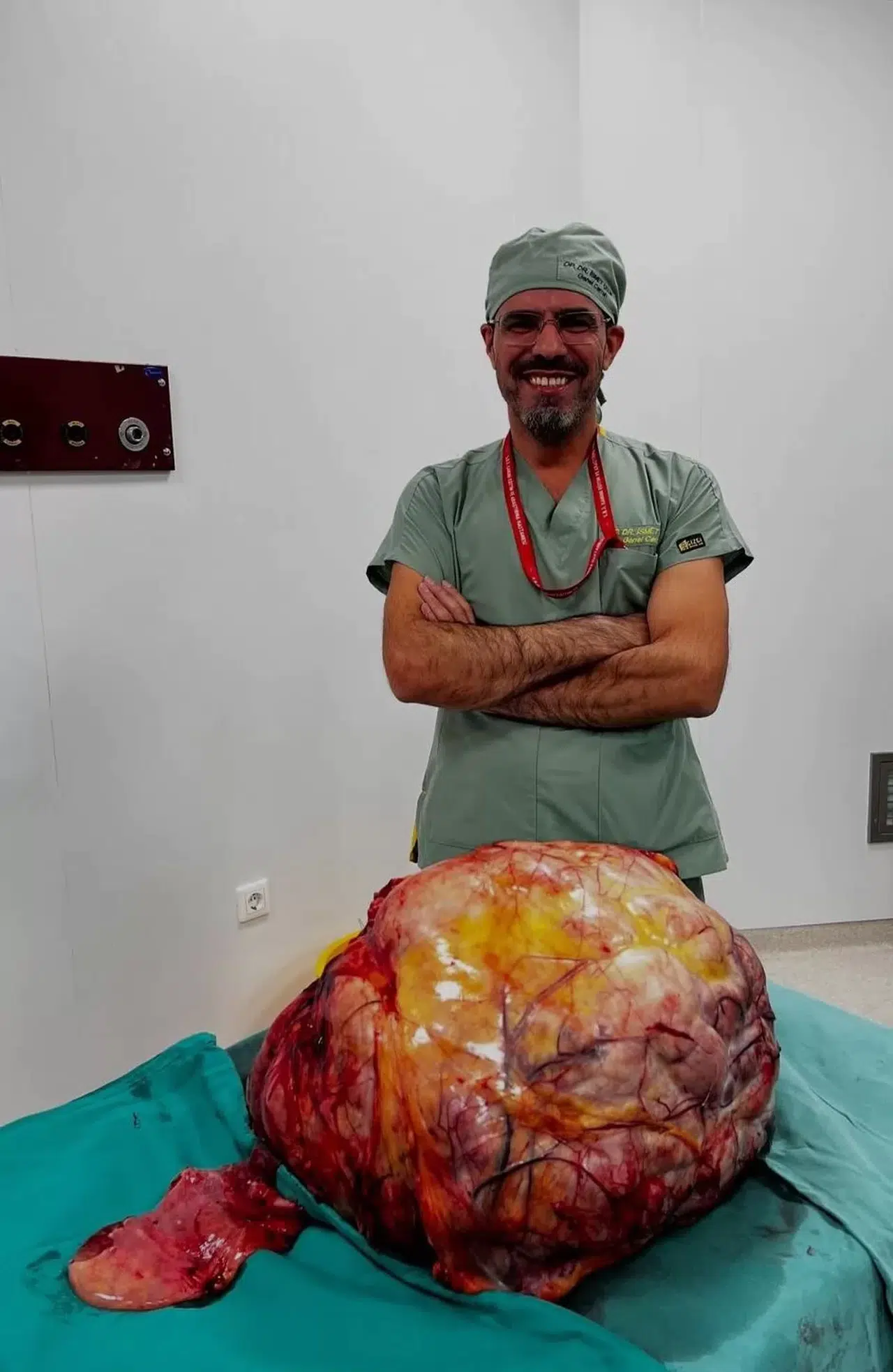 Karın Ağrısı Şikayeti ile Gelen Hastanın Karnından 26 Kilogramlık Tümör Çıktı