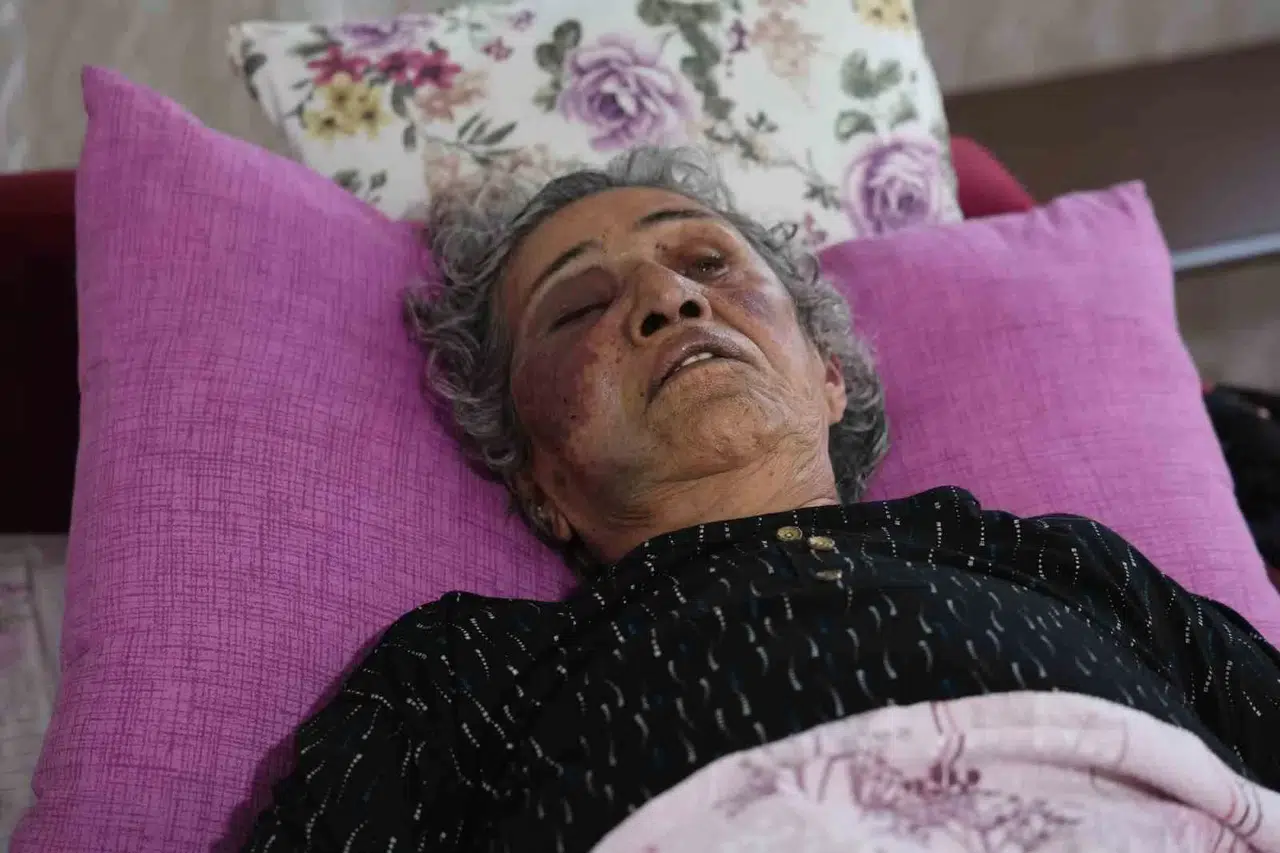 Yaşlı Bayanı Yüzüğü İçin Öldüresiye Darbetti