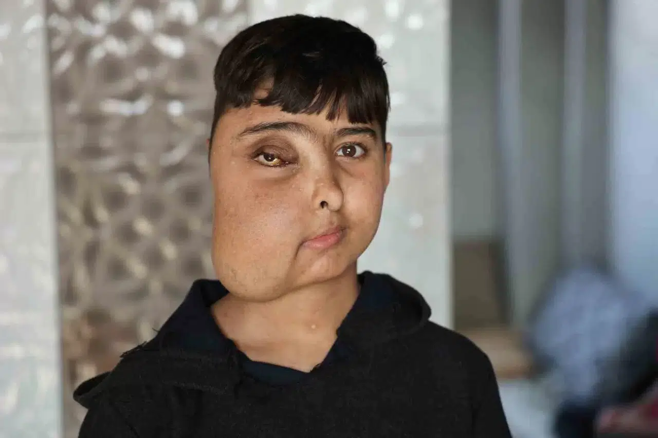 Enes Gen Tedavisiyle Sıhhatine Kavuşacak