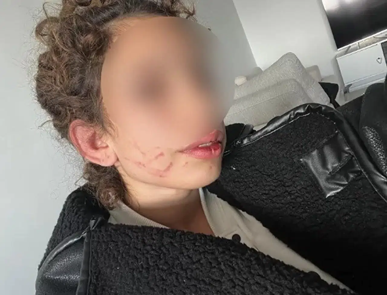 Konya’da 19 Yaşındaki Kızı Darp Eden Gençten “Kendi Kendini Yaraladı” Savunması