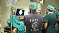Çorum’da Prostat Tedavisinde Yeni Dönem