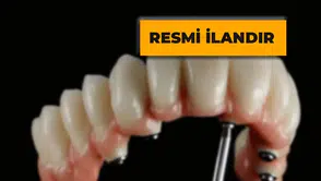 Metal Destekli Kron Hizmeti Alınacak