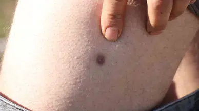 Babadan Kalan Miras, Kardeşi Ağabeye Vurdurttu