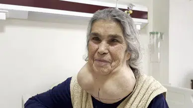 Tabipten Korktuğu İçin Yıllarca Devasa Kitleyle Yaşadı