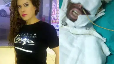 Avcılar’da Eski Sevgilisine Kimyasal Unsur ile Saldıran Sanığın Yargılanmasına Devam Edildi