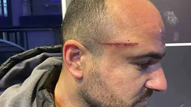 İşe Gitmek İçin Arabasına Bindi, Dehşeti Yaşadı