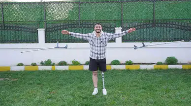 On Sene Sonra Yürümenin Memnunluğunu Yaşıyor: Uçak Bombasıyla Kaybettiği Bacağına Protezle Kavuştu