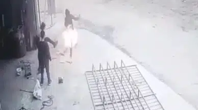 Yanan Tenekeye Tekme Attı, Arkadaşını Yaktı