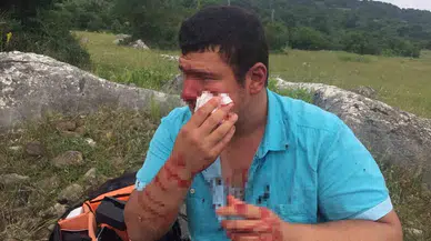 İha Muhabirini Öldüresiye Darp Eden Lütfü Türkkan’ın Adamlarının Şahidinden Güldürü Üzere Savunma