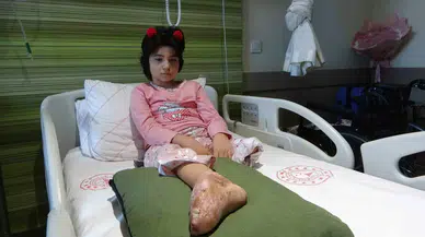 Sarsıntıda Ayaklarını Kaybeden Aysima’nın Tek İsteği Öğretmen