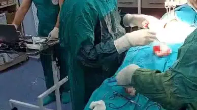 Siirt’te, Özel Aygıtla Ses Telleri Korunarak Guatr Ameliyatı Yapıldı