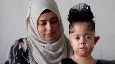 Tek Dileği Kelebek Hastası Kızına Doyasıya Sarılabilmek