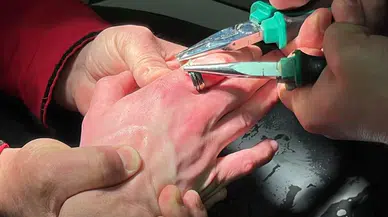 Parmağına Yüzük Sıkışan Vatandaşı İtfaiye Kurtardı