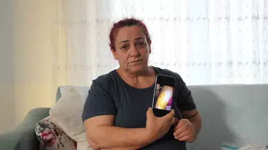Köpek Hücumunda Yaşadığı Dehşet Anlarını Unutamayan Bayan Tek Başına Sokağa Çıkamıyor