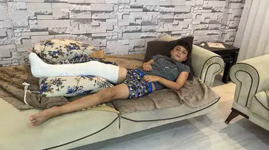 Futbolcu Olma Hayali Kuran 10 Yaşındaki Çocuk Köpeklerden Kaçarken Bacağını Kırdı