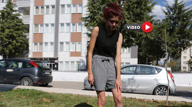 Maymunun Saldırdığı Genç Kız Konuştu: Ben Önce Kedi Zannettim