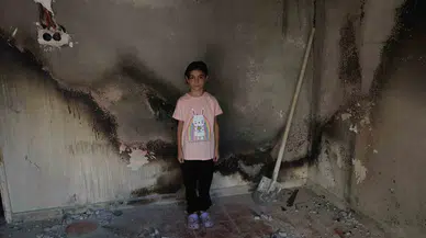 Lösemi Hastası Almina’nın Meskeni Yandı