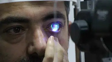 Sol Gözüne Kaçan Japon Yapıştırıcısı Hastanelik Etti