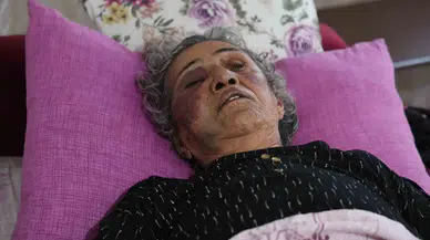 Yaşlı Bayanı Yüzüğü İçin Öldüresiye Darbetti