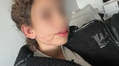 Konya’da 19 Yaşındaki Kızı Darp Eden Gençten “Kendi Kendini Yaraladı” Savunması