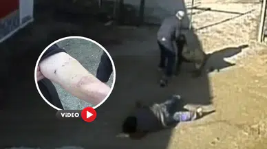 Köpek Yaşlı Çifte Saldırdı, O Anlar Böyle Kaydedildi