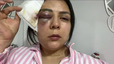 Yürürken Akına Uğrayan Genç Kız Konuştu: "Psikolojim Altüst Oldu"