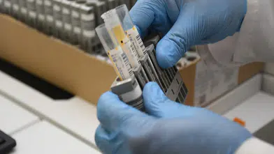 Çorum’daki Hastanede Yapay Zeka Dönemi Başladı