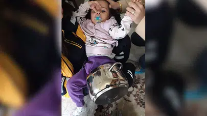 Çorum’da Bebek, Tencereye Sıkıştı, İtfaiye Güçlükle Kurtardı