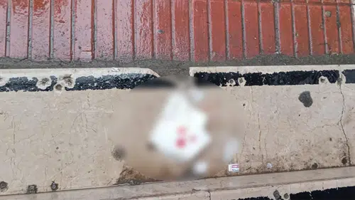 Alışveriş Çıkışı Talihsiz Kaza