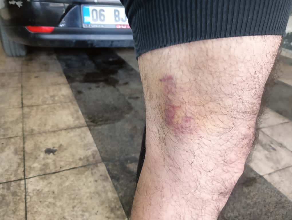 ayirmaya-calistigi-kavga-nedeniyle-3-yasindaki-oglunun-yaninda-saldiriya-ugradi