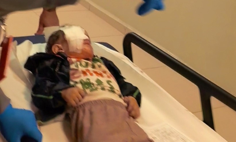 bursada-torpil-faciasinda-2-yasindaki-cocuk-agir-yaralandi