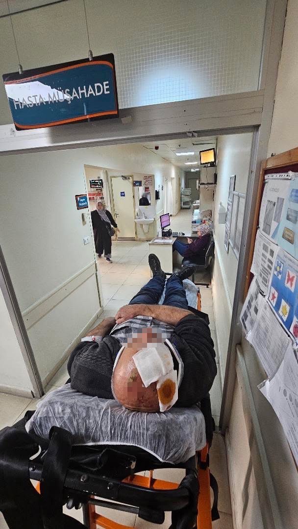 sakaryada-merdivenden-dusen-sahis-yaralandi