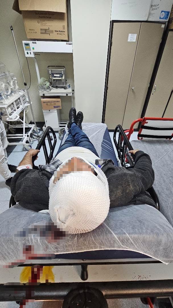 sakaryada-merdivenden-dusen-sahis-yaralandi